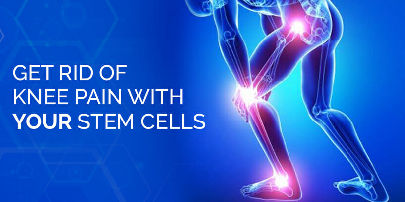 StemCell Therapy for KneePain