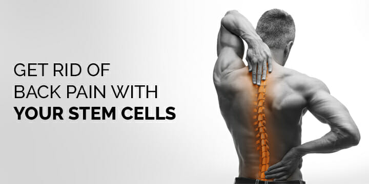 Stem Cell Therapy for Back Pain in Cincinnati