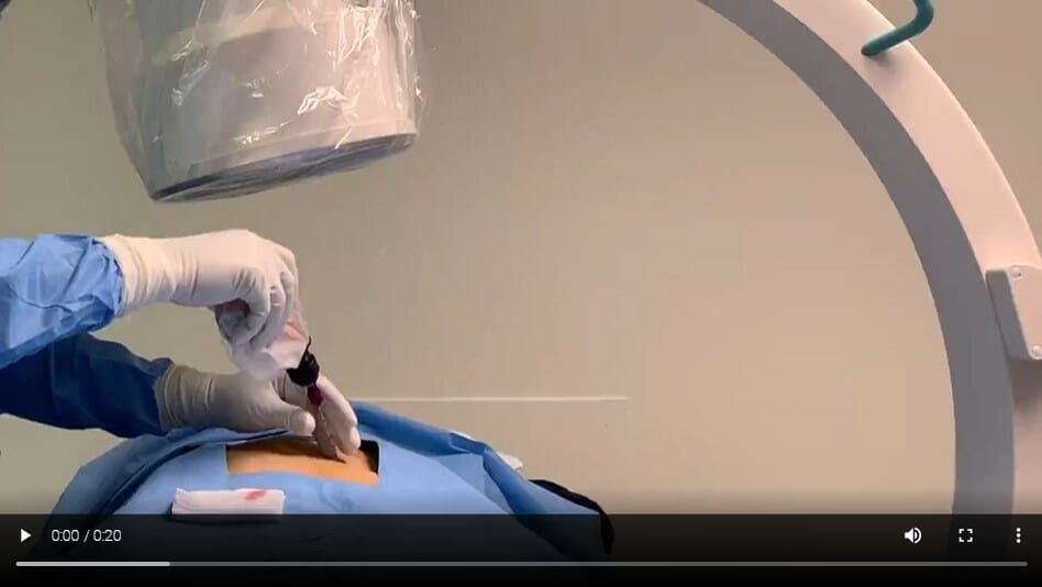 stem cell treatment for back pain cost stem cell treatment for back pain cost