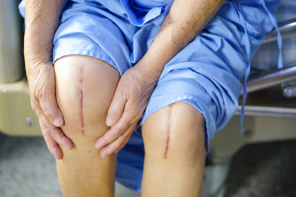 disadvantages of knee replacement