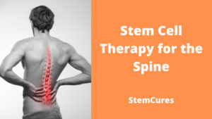 stem-cell-therapy-for-spine