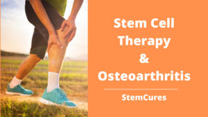 stem-cell-therapy-for-osteoarthritis