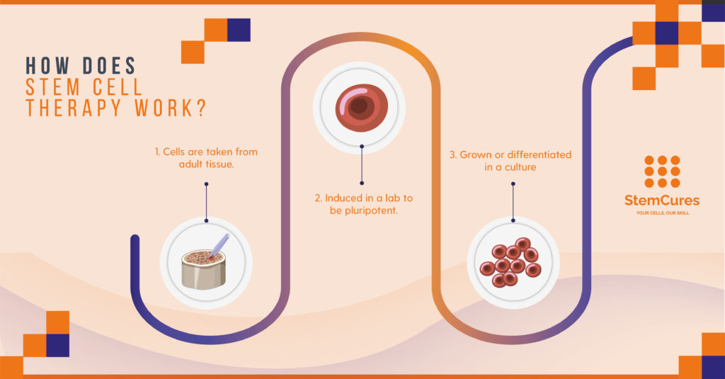 Differences between Prolotherapy, Stem Cell Therapy, and PRP - How Do Stem Cells Work