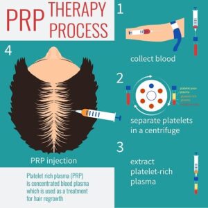 Differences between Prolotherapy, Stem Cell Therapy, and PRP - PRP