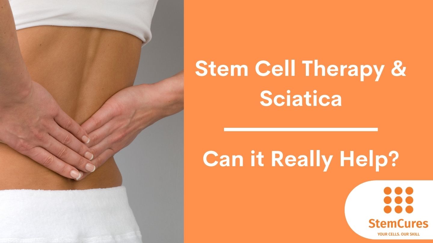 https://www.stemcures.com/wp-content/uploads/2023/06/Stem-Cell-Therapy-Sciatica.jpg