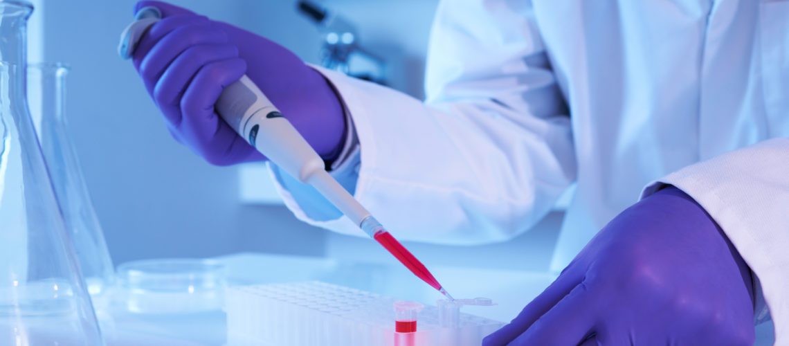 Scientist using pipette in laboratory selective focus